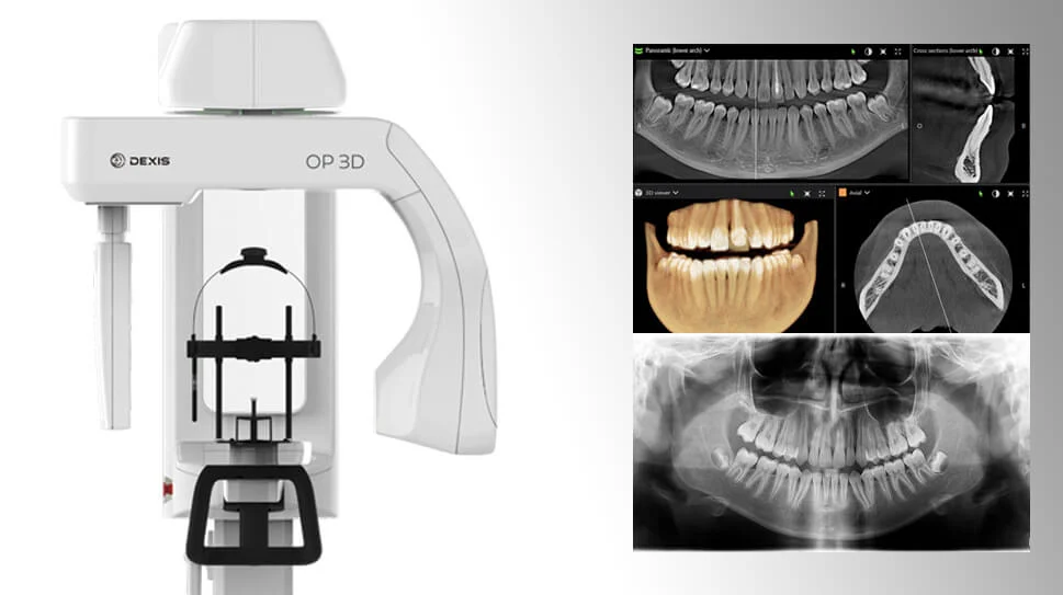 panoramic_x-ray